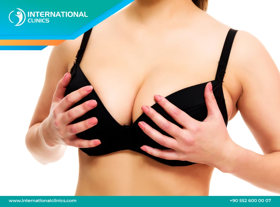 Breast Lift Before and After Without Implant