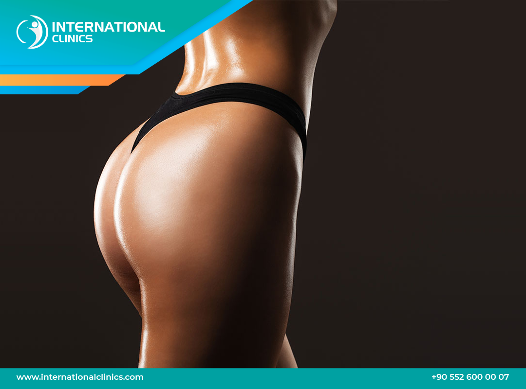 Brazilian butt lift in Turkey - Safe & Low Cost and  Recovery
