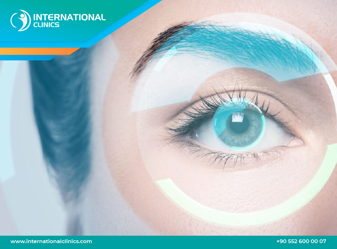 Lens Replacement Surgery in Turkey - Cost, Procedure & What to Expect