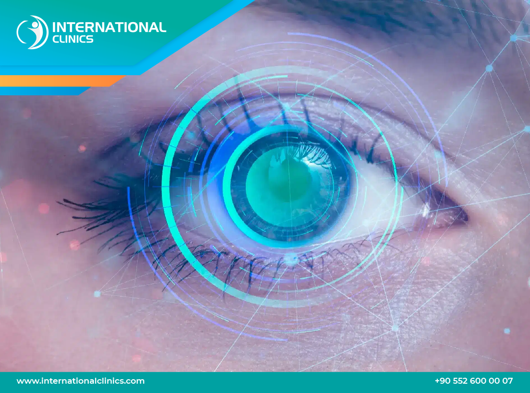 Lasik Eye Surgery in Turkey- Procedure & Perfect Cost