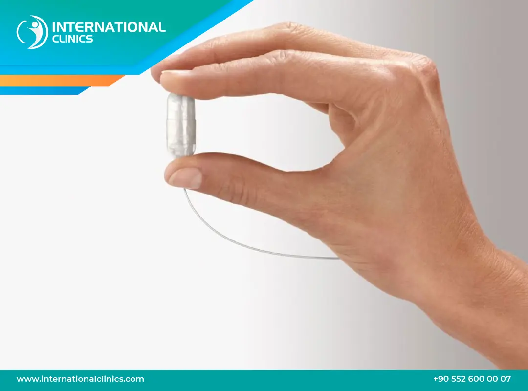 الكبسولة الذكية للتخسيس في تركيا: سر فقدان الوزن الفعال والآمن!