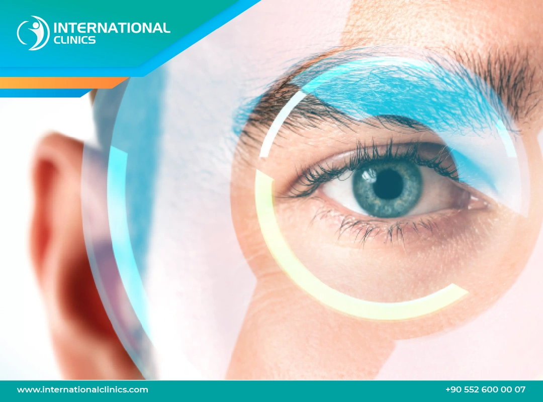 Can You Get LASIK Twice? Safety, Candidacy & Alternatives