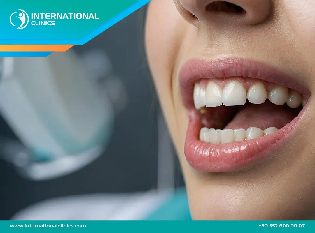 زراعة الأسنان قبل وبعد: شاهد تحول ابتسامتك