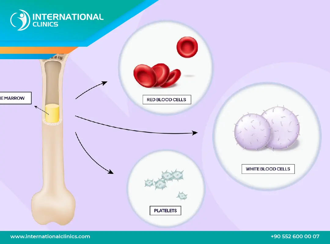 فشل النخاع العظمي وطرق علاجه: من أدوية المناعة حتي عملية زراعة النخاع