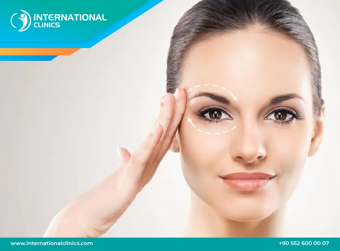 عملية عيون القطة (Canthoplasty) | الفوائد، الخطوات، ومدة التعافي