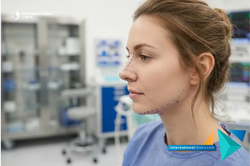 Aesthetic close-up of facial planning lines for Piezo Rhinoplasty in Turkey at International Clinics.