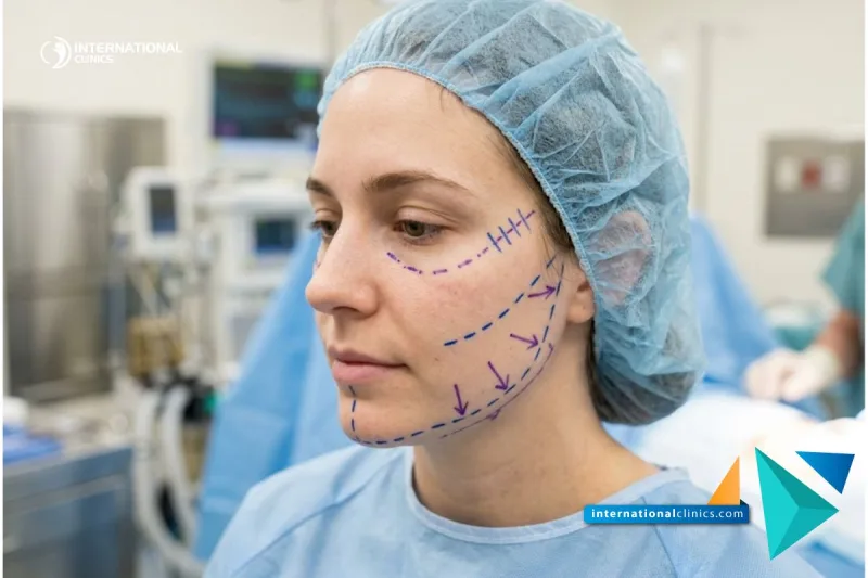Close-up photograph of a patient's face marked with surgical planning lines for Facial Bone Contouring in Turkey at International Clinics.