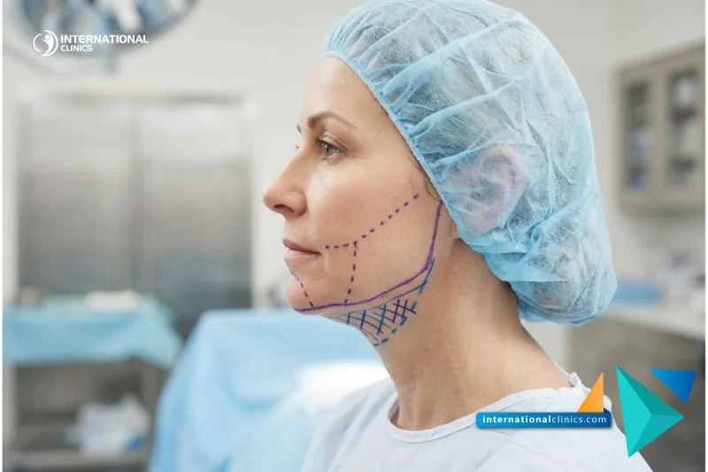 Close-up shot of surgical neck planning lines for Deep Neck Contouring Cost in Turkey at International Clinics