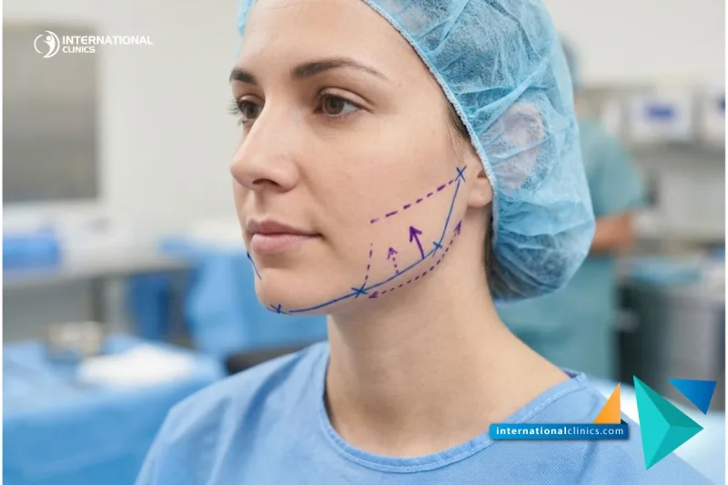 Photo clinique montrant les lignes de planification pour le Meilleur chirurgien plastique maxillo-facial en Turquie chez International Clinics.
