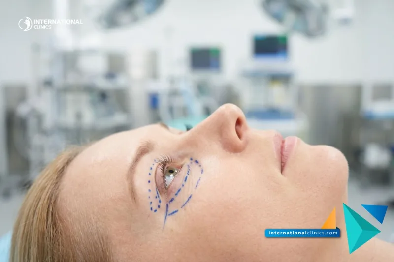 Under Eye Bag Removal Surgery Cost - Best Guide