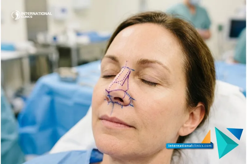 Reconstructive Rhinoplasty in Turkey - Guide