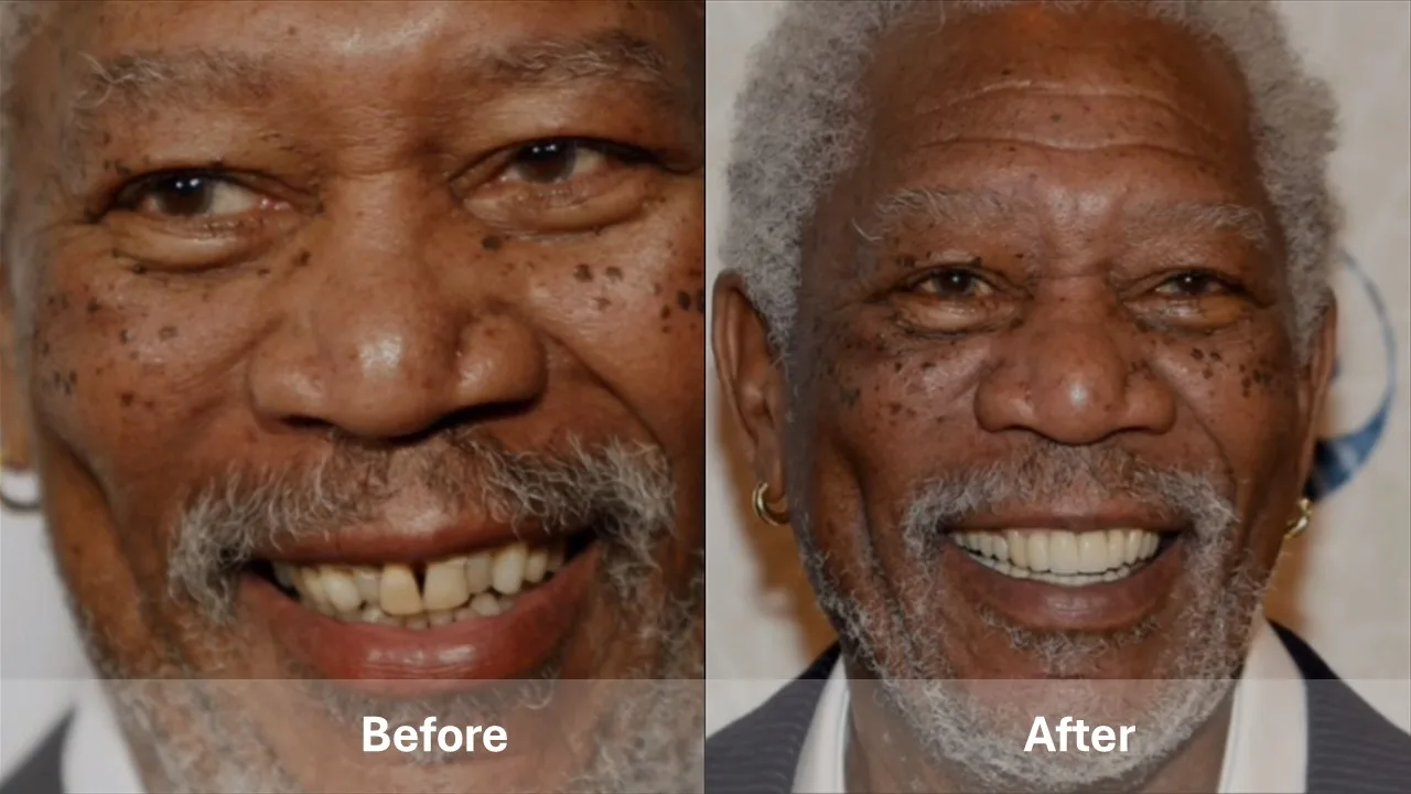 Morgan Freeman   celebrity dental implant