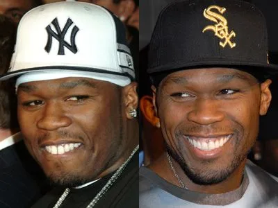 50 Cent  celebrity dental implant
