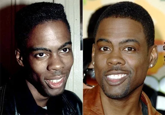 Chris Rock  celebrity dental implant