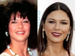Catherine Zeta-Jones  celebrity dental implant
