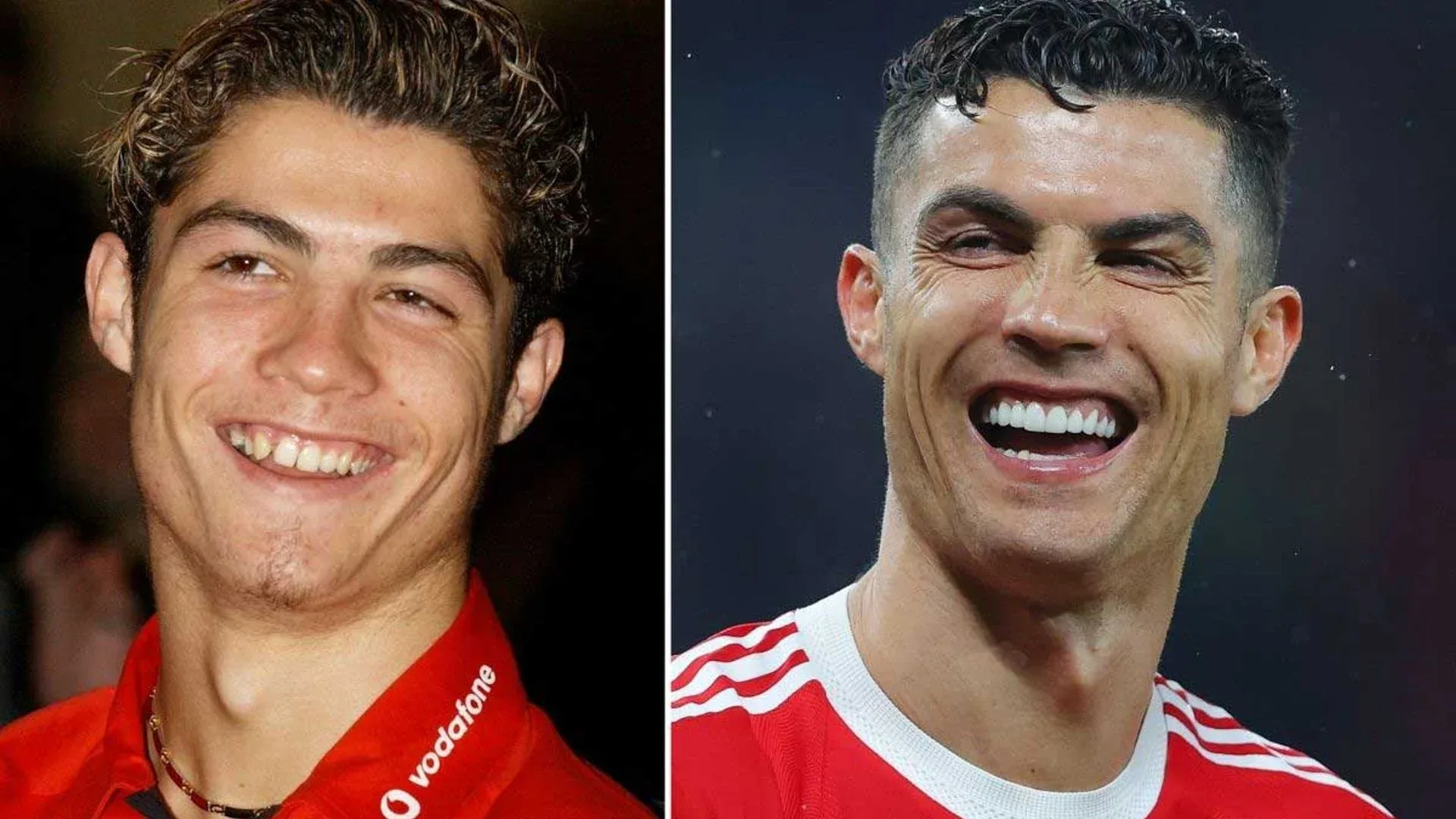 Cristiano Ronaldo   celebrity dental implant