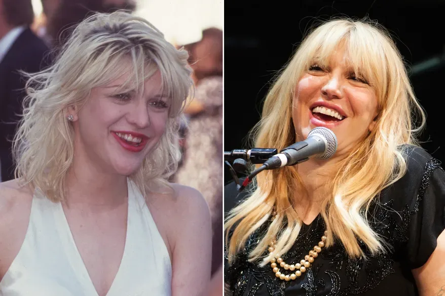 Courtney Love  celebrity dental implant