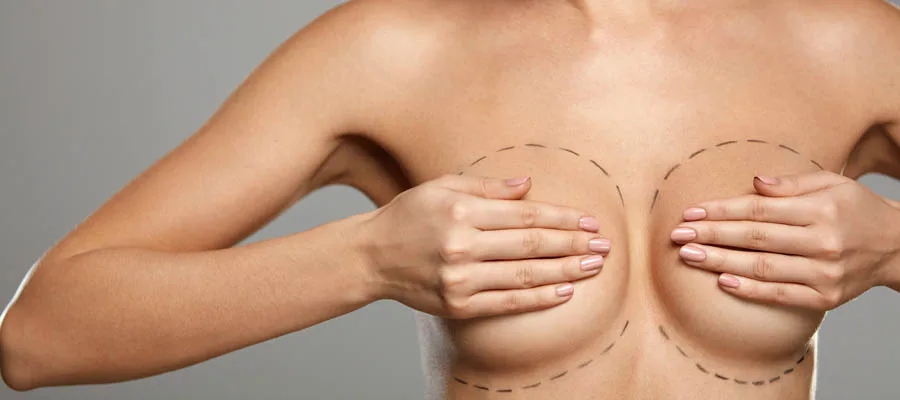 Lifting des seins