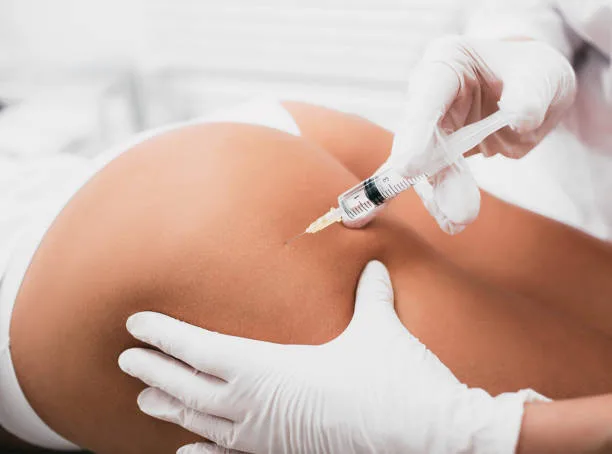 Silicone Buttocks Injections