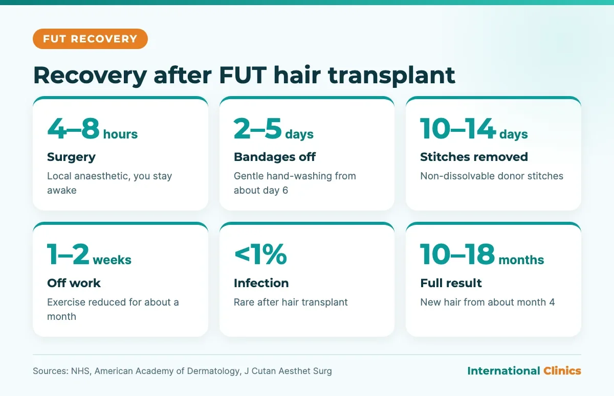 FUT hair transplant recovery infographic: 4 to 8 hour surgery, bandages off at 2 to 5 days, stitches out at 10 to 14 days, 1 to 2 weeks off work