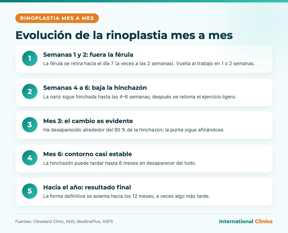 Infografía de la evolución de una rinoplastia mes a mes: férula a la semana, hinchazón de 4 a 6 semanas, 90 % resuelta a los 3 meses y resultado final hacia el año