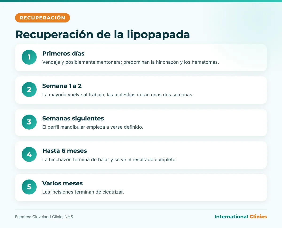 Infografía de la recuperación de la lipopapada: vendaje, vuelta al trabajo en 1 o 2 semanas y resultado completo hasta los 6 meses