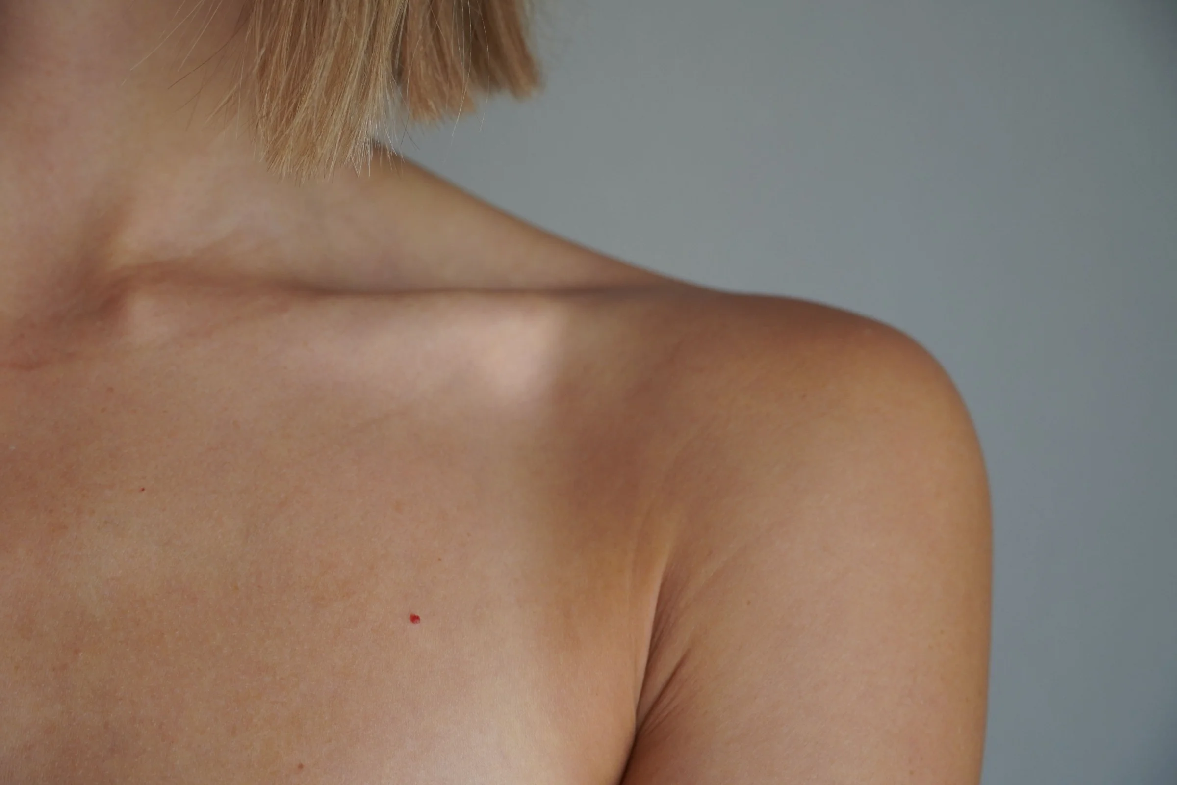 All-Inclusive Breast Reduction Package