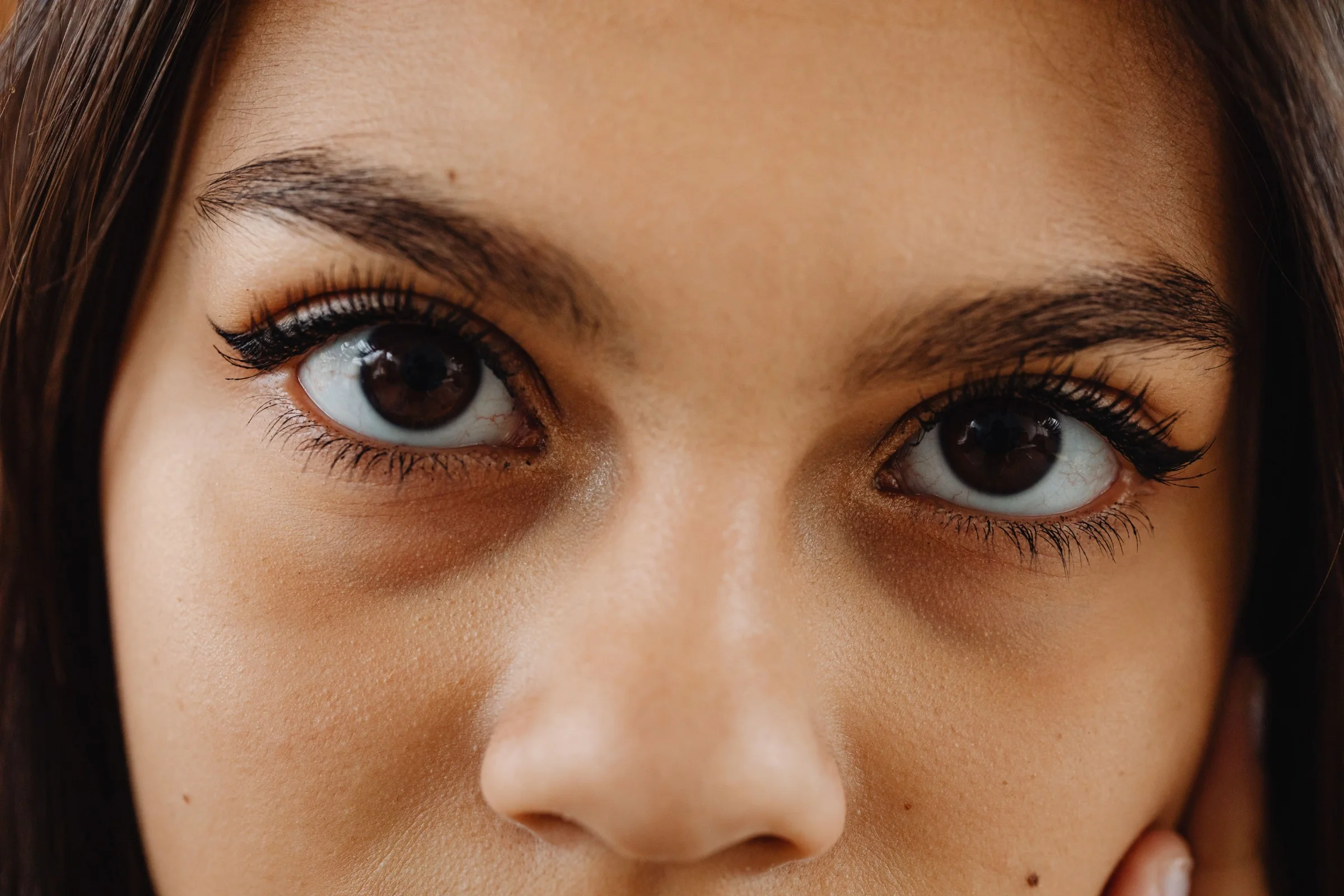 All-Inclusive Upper & Lower Blepharoplasty Package