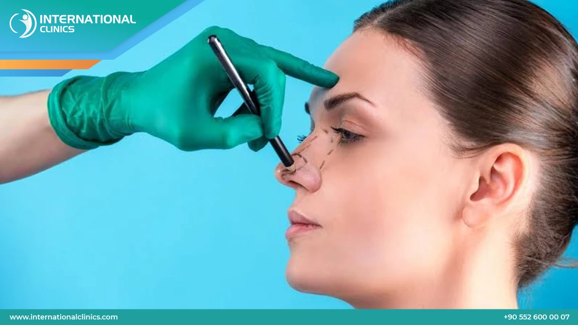 عمليات تجميل الانف في تركيا: أبرز أنواعها وتقنياتها ومميزاتها 2025 