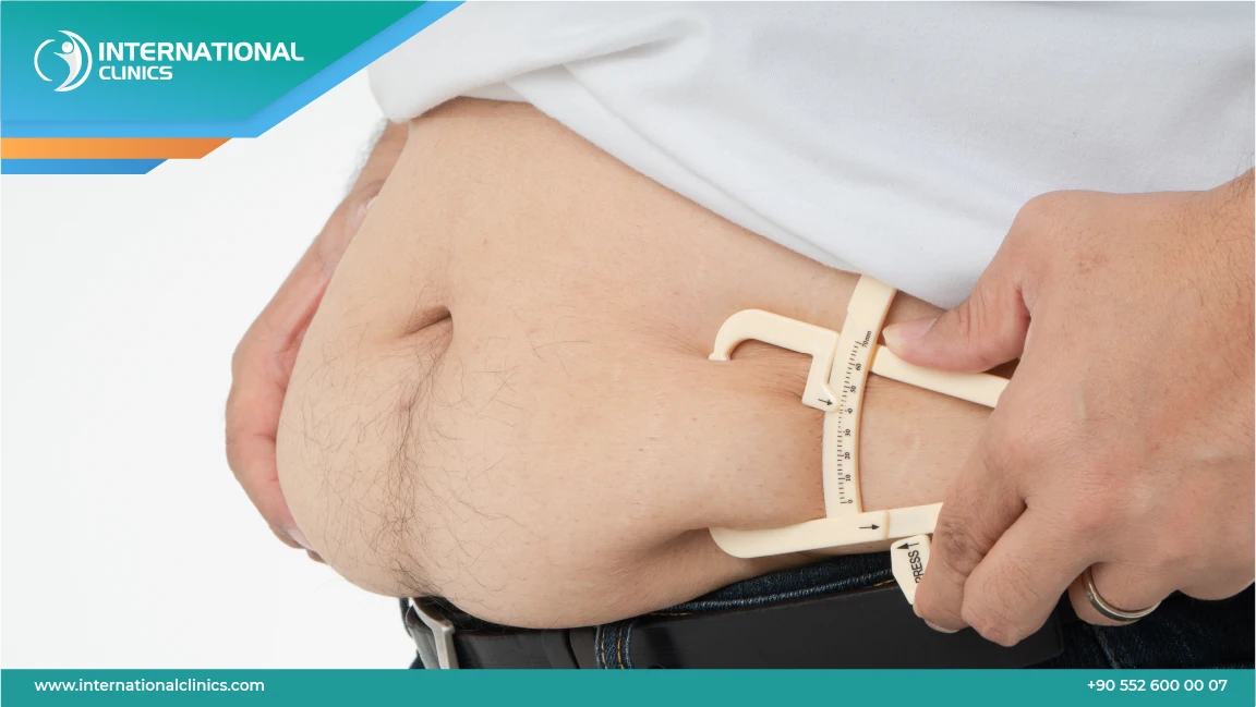 عملية شفط الدهون: كل ما تحتاج معرفته قبل وبعد الجراحة