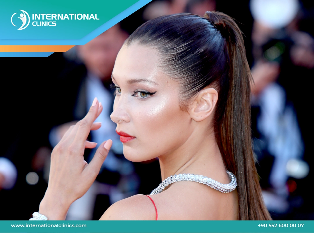 What is a Ponytail Facelift Surgery Procedure? 2024 | International Clinics