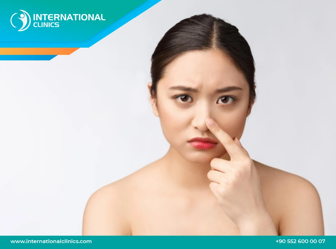 انحراف الحاجز الأنفي: تعرف على أبرز الأسباب والأعراض وأفضل الحلول