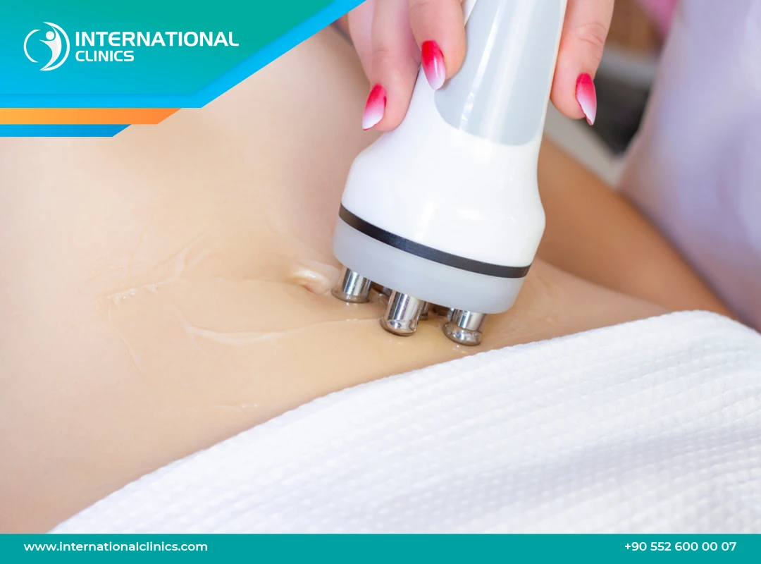 شد الجسم بالليزر 2025 | الدليل الكامل للتجميل والنحت المتقدم