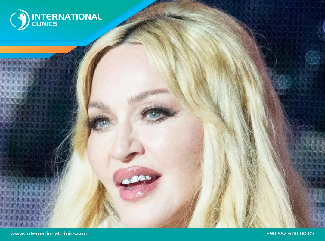 Madonna Plastic Surgery: A Journey of Transformation and Controversy