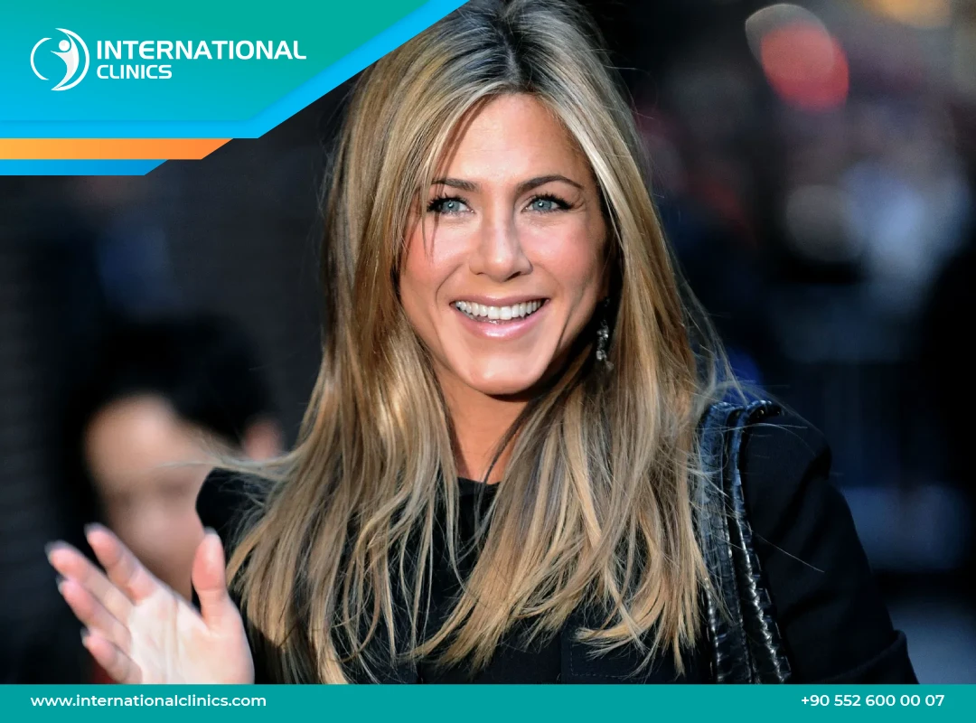 Jennifer Aniston: un débat indéterminé autour de la chirurgie esthétique.