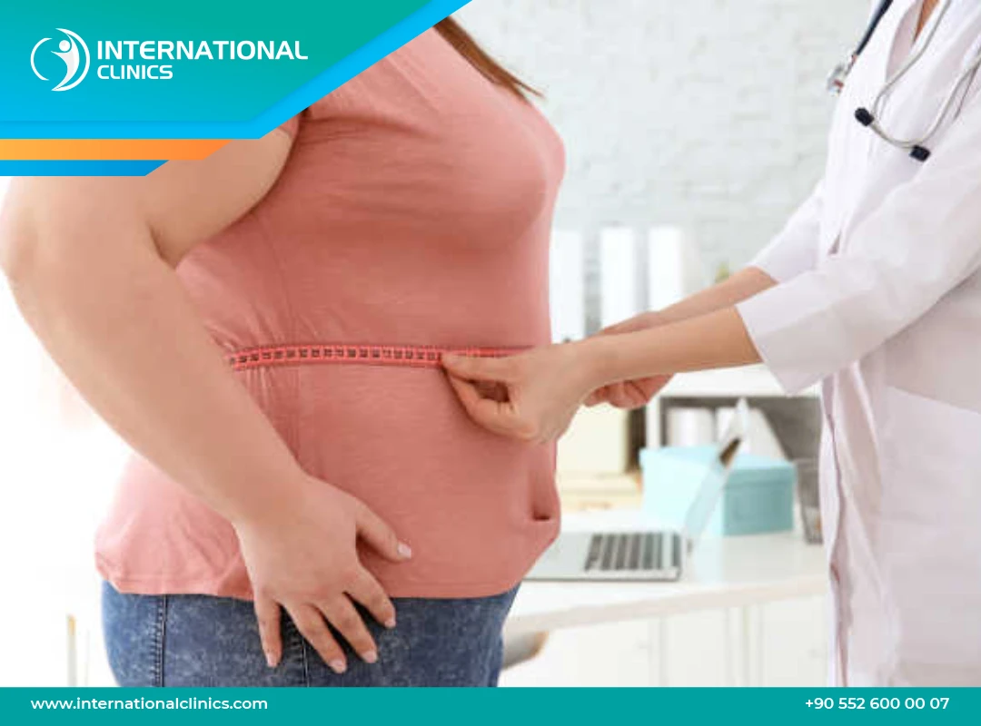 Gastric Bypass Surgery in Turkey: Procedure Benefits & Costs