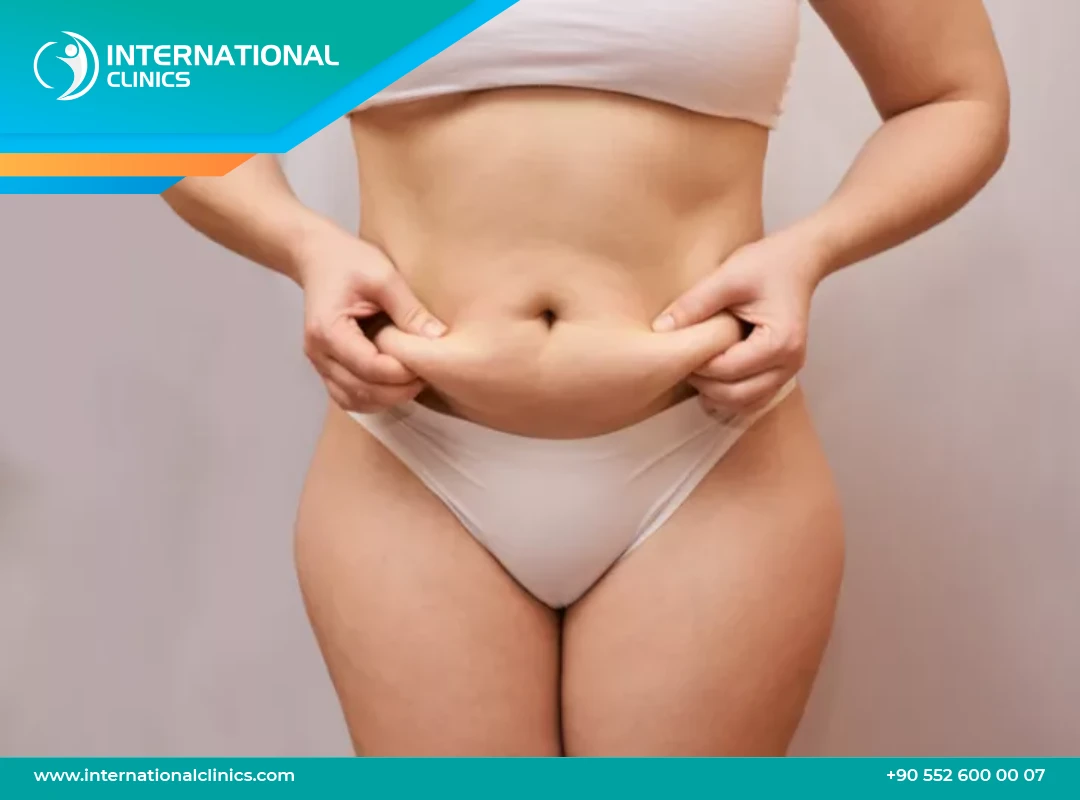 Abdominoplastie prix : Une silhouette réinventée en Turquie 2025