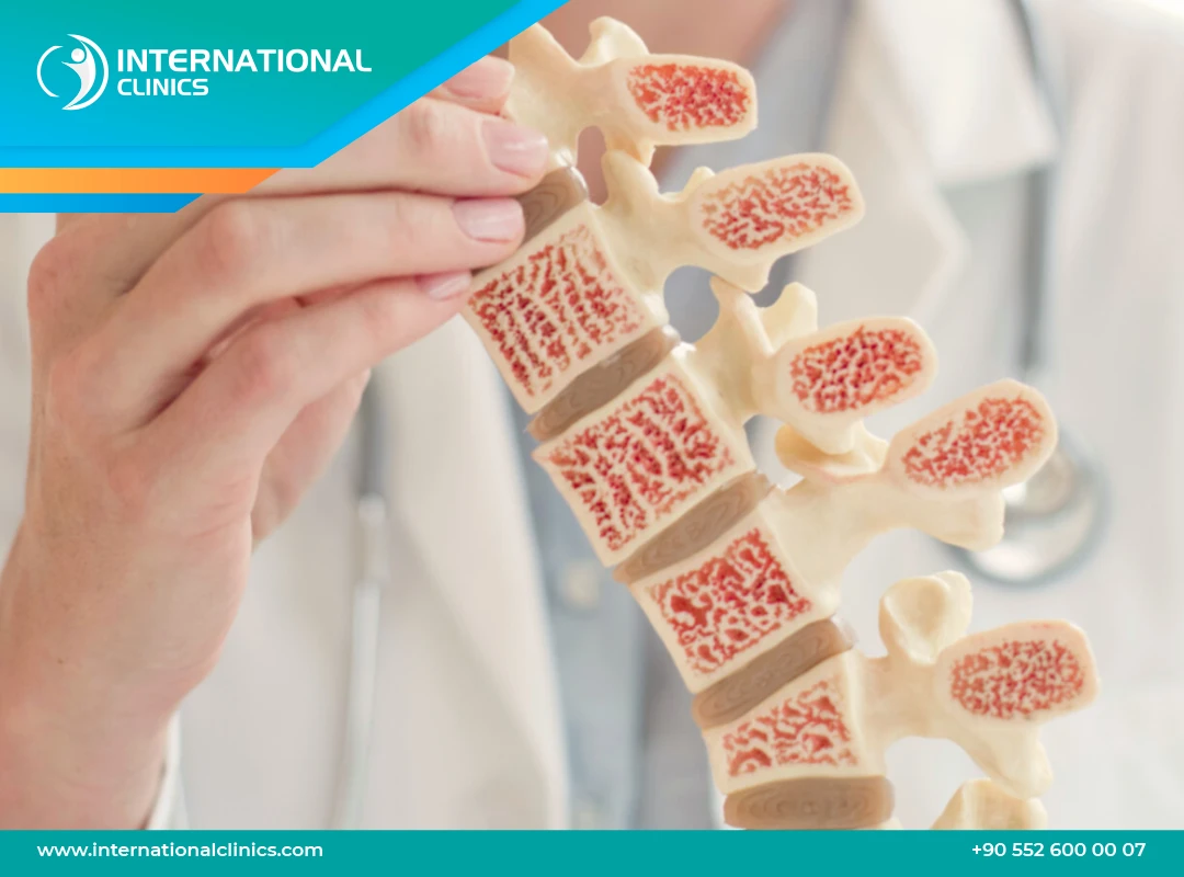 اعراض هشاشة العظام: تعرف على التشخيص وطرق الوقاية والعلاج