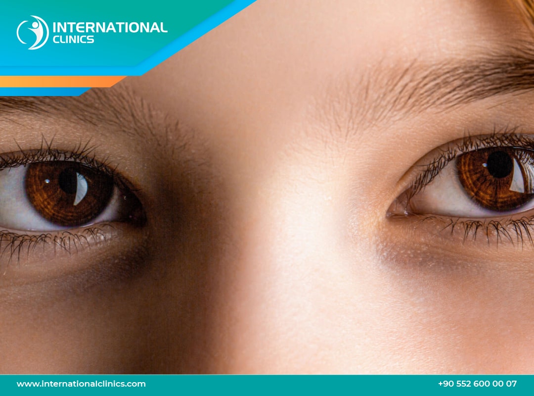 تجربتي مع عملية الحول للاطفال: الاجراءات، المضاعفات