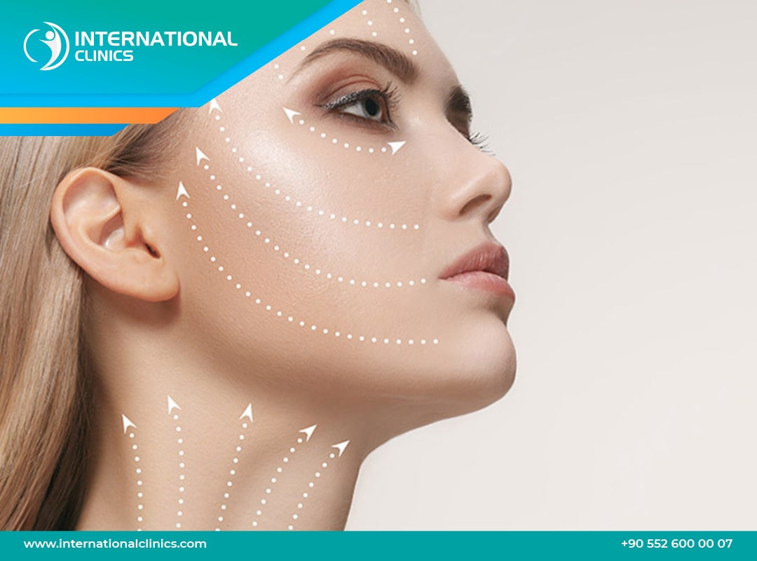 Mini lifting visage en Turquie | Prix & Résultats - International Clinics