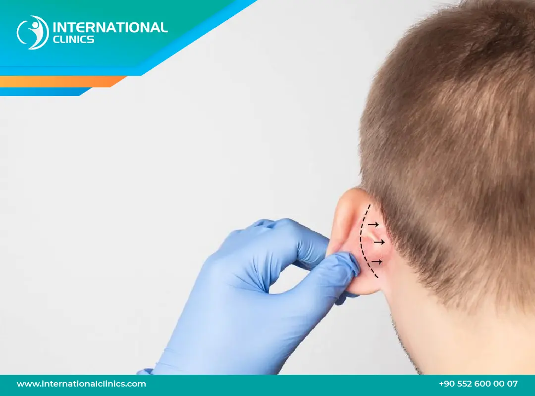 تجميل الأذن في تركيا: دليلك الشامل للأنواع والتكلفة والنقاهة