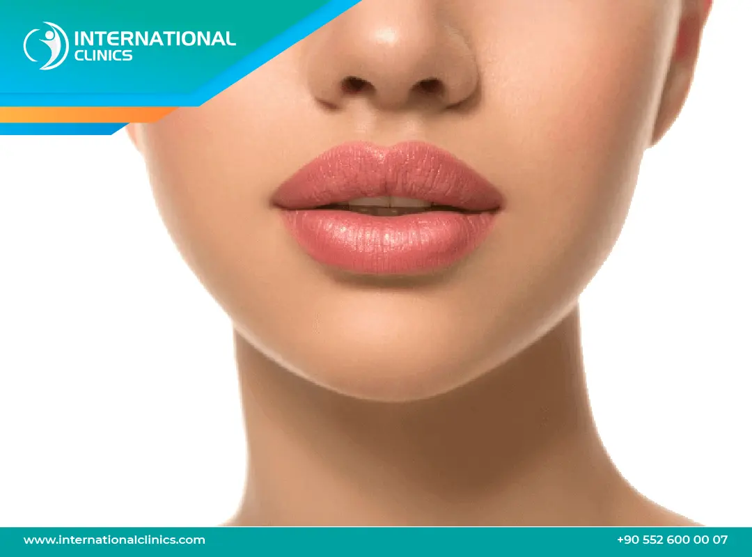 تجميل الشفاه في تركيا: الأنواع و النتائج والتكاليف