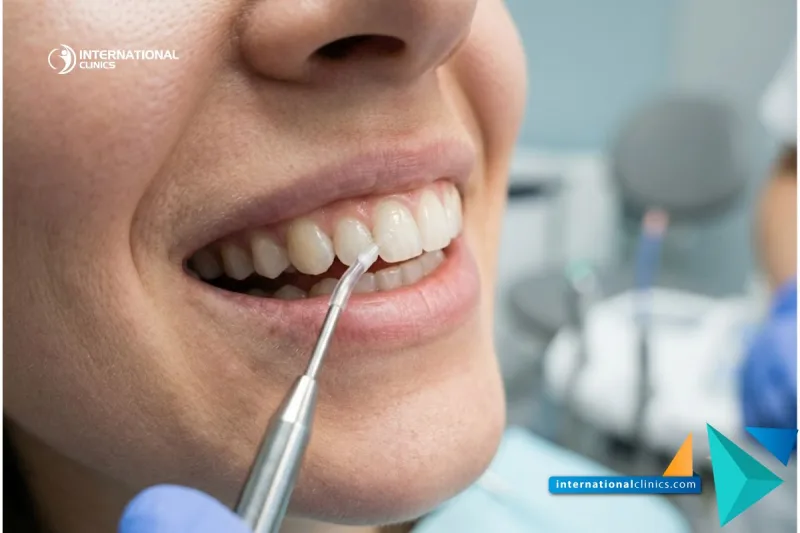 Dentisterie Conservatrice - Guide