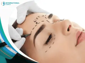 Eyebrow lift 1 عمليات تجميل الوجه