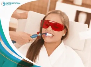 Laser teeth whitening ابتسامة هوليود المتحركة