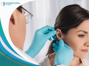Otoplasty2 عملية تصغير الأذن