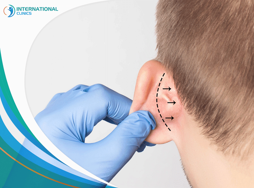 تصغير الأذن | الطرق الجراحية وغير الجراحية