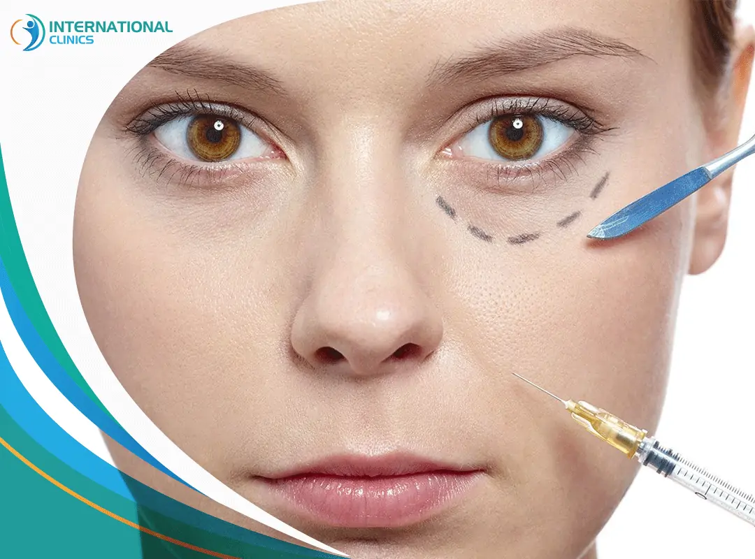 Collagen injections under the eyes حقن الكولاجين تحت العين