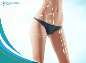 liposuction8 شفط دهون المؤخرة