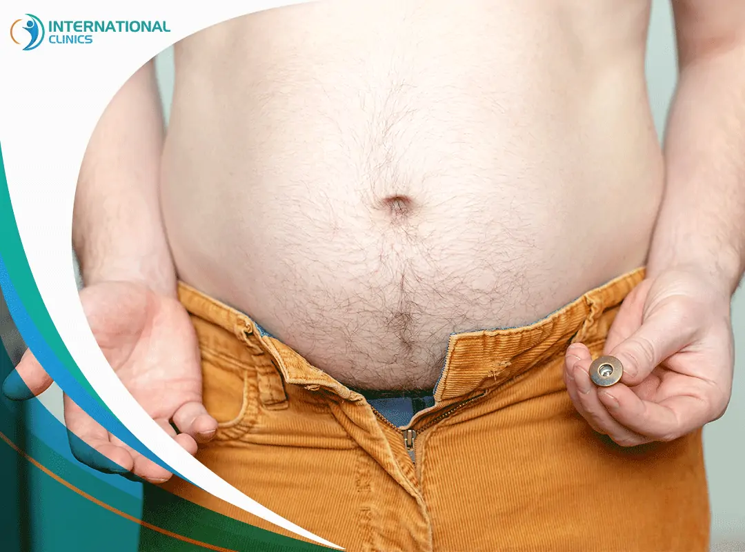 man liposuction شفط الدهون للرجال